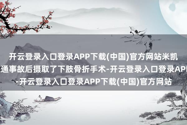 开云登录入口登录APP下载(中国)官方网站米凯尔·安东尼奥在这起交通事故后摄取了下肢骨折手术-开云登录入口登录APP下载(中国)官方网站